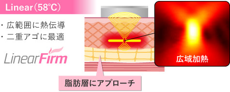 リニアファームモード