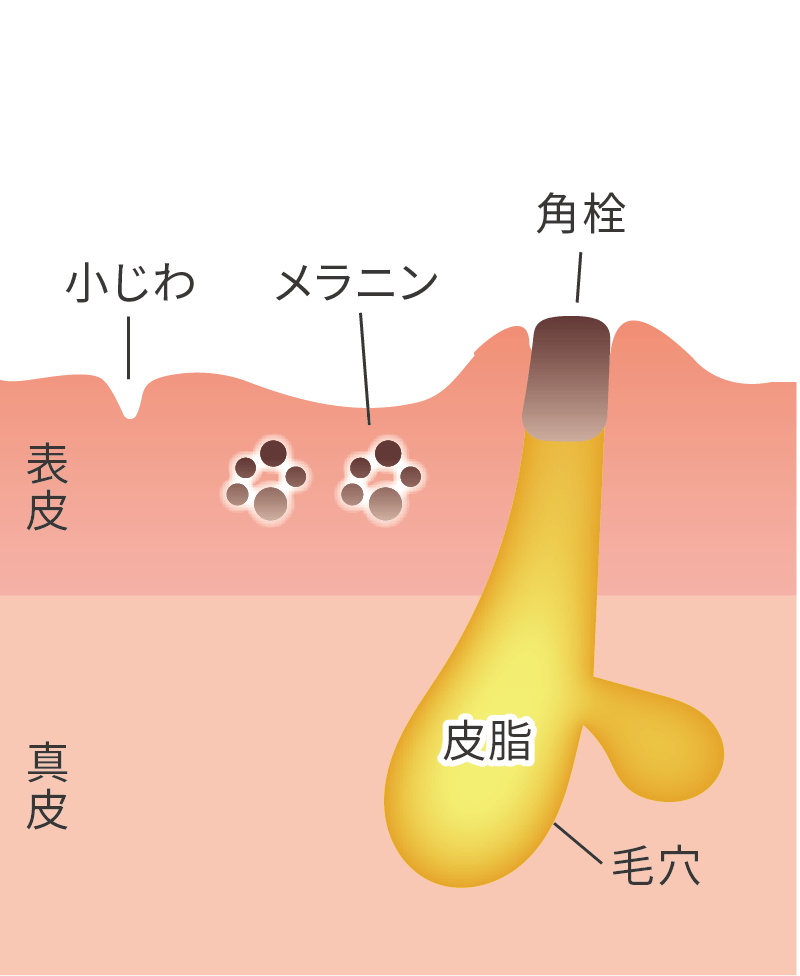 肌の表面に古い角質が溜まっている状態