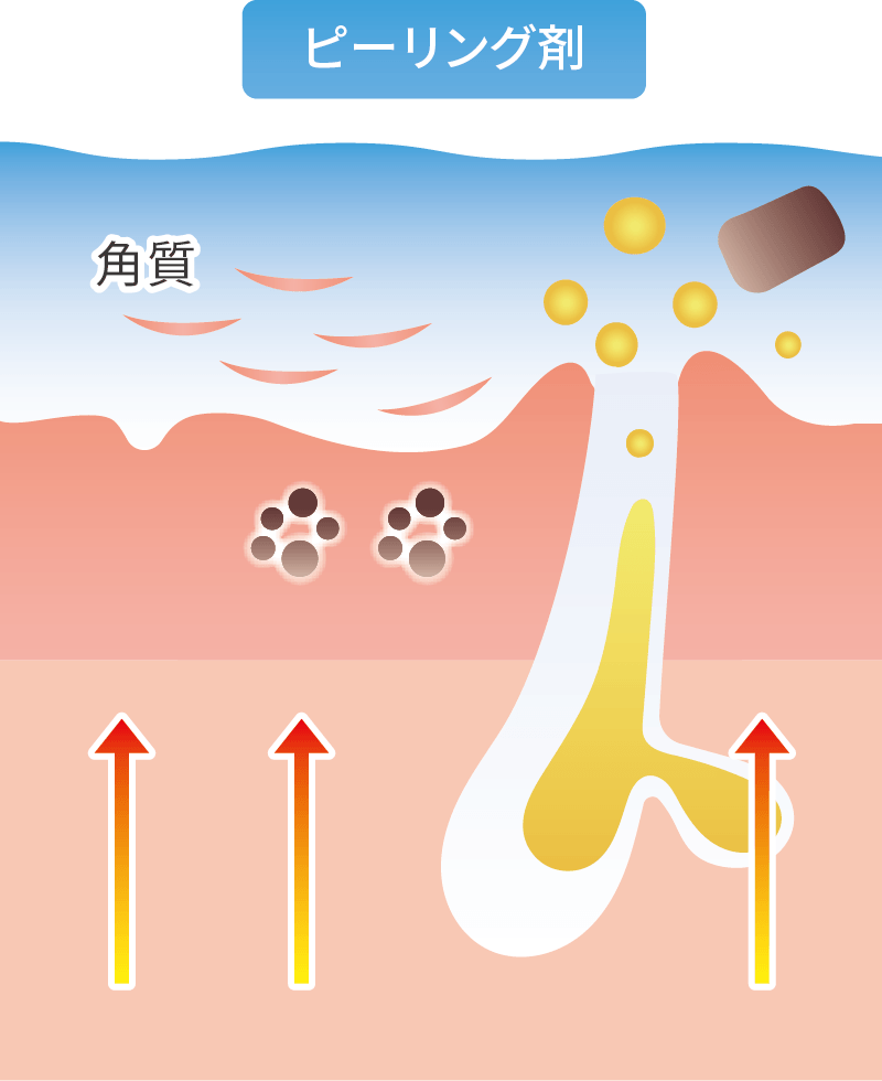 サリチル酸ピーリングの効果